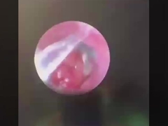 الطائر الفراش أدوات الجراحة