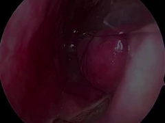 أجهزة الأبحاث العصبية الضعيفة للغاية والمرنة PLA407